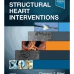 Handbook of Structural Heart Interventions