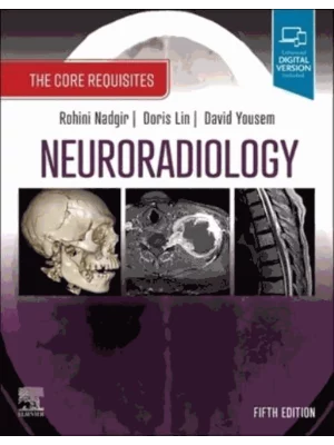Neuroradiology: The Core Requisites, 5e