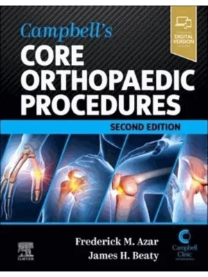 Campbell's Core Orthopaedic Procedures, 2nd Edition