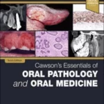 Cawson's Essentials of Oral Pathology and Oral Medicine, 10th Edition