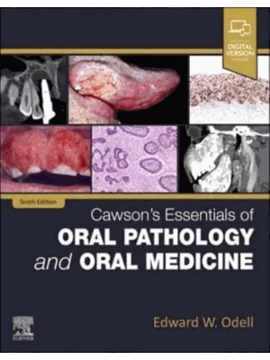Cawson's Essentials of Oral Pathology and Oral Medicine, 10th Edition