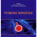 Tumori hipofize