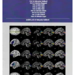 Neuroanatomija