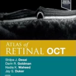 Atlas of Retinal OCT, 2nd Edition Optical Coherence Tomography