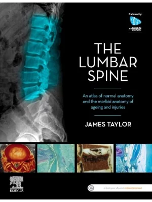 The Lumbar Spine An Atlas of Normal Anatomy and the Morbid Anatomy of Ageing and Injury