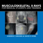 Musculoskeletal X-rays PB