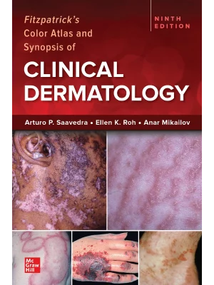 Ie Fitzpatrick's Color Atlas And Synopsis Of Clinical Dermatology, 9th Edition