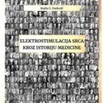 Elektrostimulacija srca kroz istoriju medicine