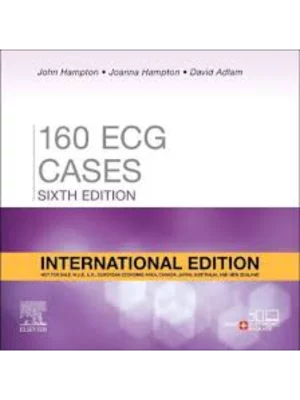 160 Ecg Cases, International Edition