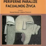 Periferne paralize facijalnog živca