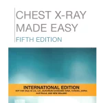 Chest X-Ray Made Easy, 5th Edition, International Edition