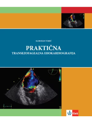 Praktična transezofagealna ehokardiografija