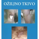 Ožiljno tkivo