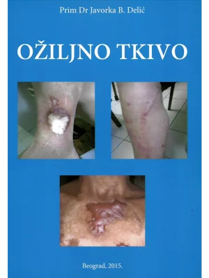 Ožiljno tkivo