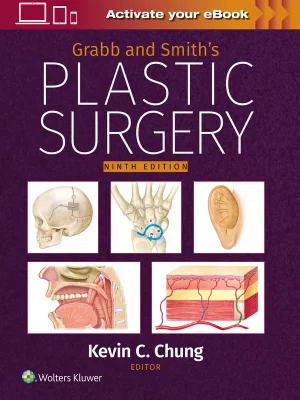 Grabb and Smith's Plastic Surgery, 9th edition