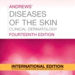 Andrews' Diseases Of The Skin, International Edition