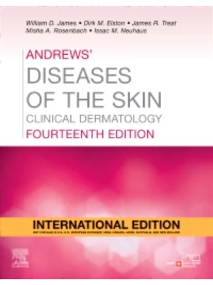 Andrews' Diseases Of The Skin, International Edition