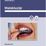 Malokluzije