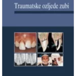 Traumatske ozljede zubi