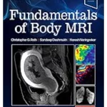 Fundamentals of Body MRI , 3rd Edition