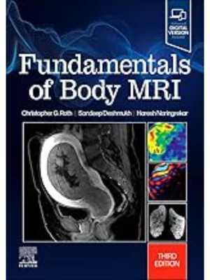 Fundamentals of Body MRI , 3rd Edition
