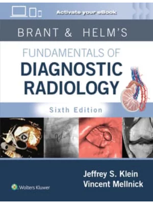Brant Fundamentals Diagnostic Rad 6E Cb