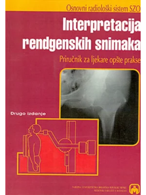 Inerpretacija rendgenskih snimaka