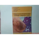 Fibrocistične promene dojke : morfologija - dijagnostika - terapija