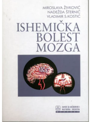 Ishemička bolest mozga