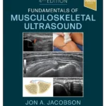Fundamentals of Musculoskeletal Ultrasound 4th edition