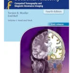Pocket Atlas of Sectional Anatomy, Volume 1: Head and Neck: Computed Tomography and Magnetic Resonance Imaging