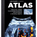 ATLAS slikovnih nalaza transabdominalnim ultrazvukom u ženskoj zdjelici