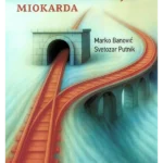 Revaskularizacija miokarda