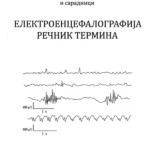 Elektroencefalografija rečnik termina
