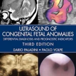 Ultrasound of Congenital Fetal Anomalies:3rd Edition Differential Diagnosis and Prognostic Indicators3rd edition