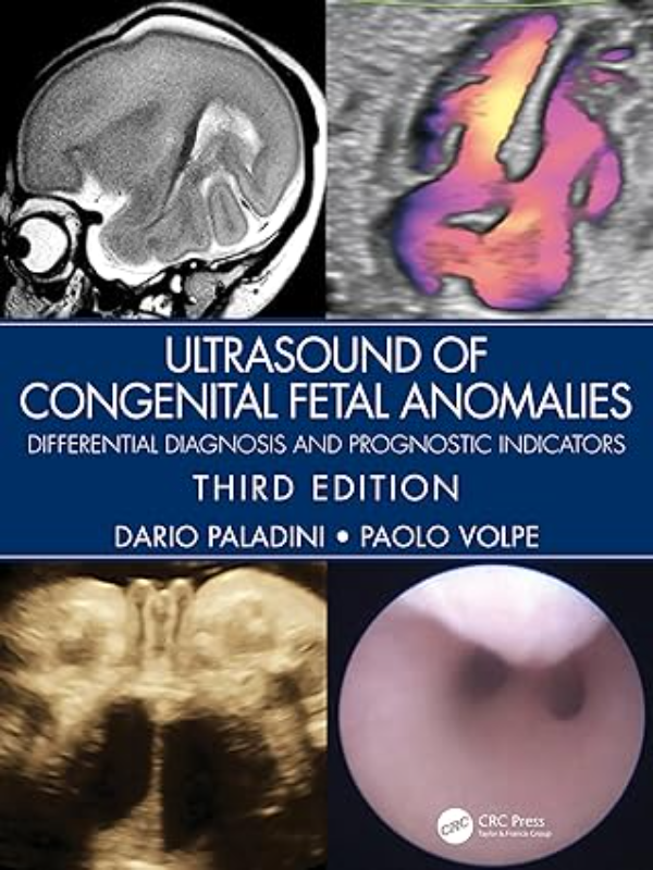 9780367499501 Ultrasound of Congenital Fetal Anomalies:3rd Edition Differential Diagnosis and Prognostic Indicators3rd edition - Slika 1