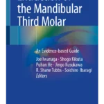 Extraction of the Mandibular Third Molar: An Evidence-based Guide